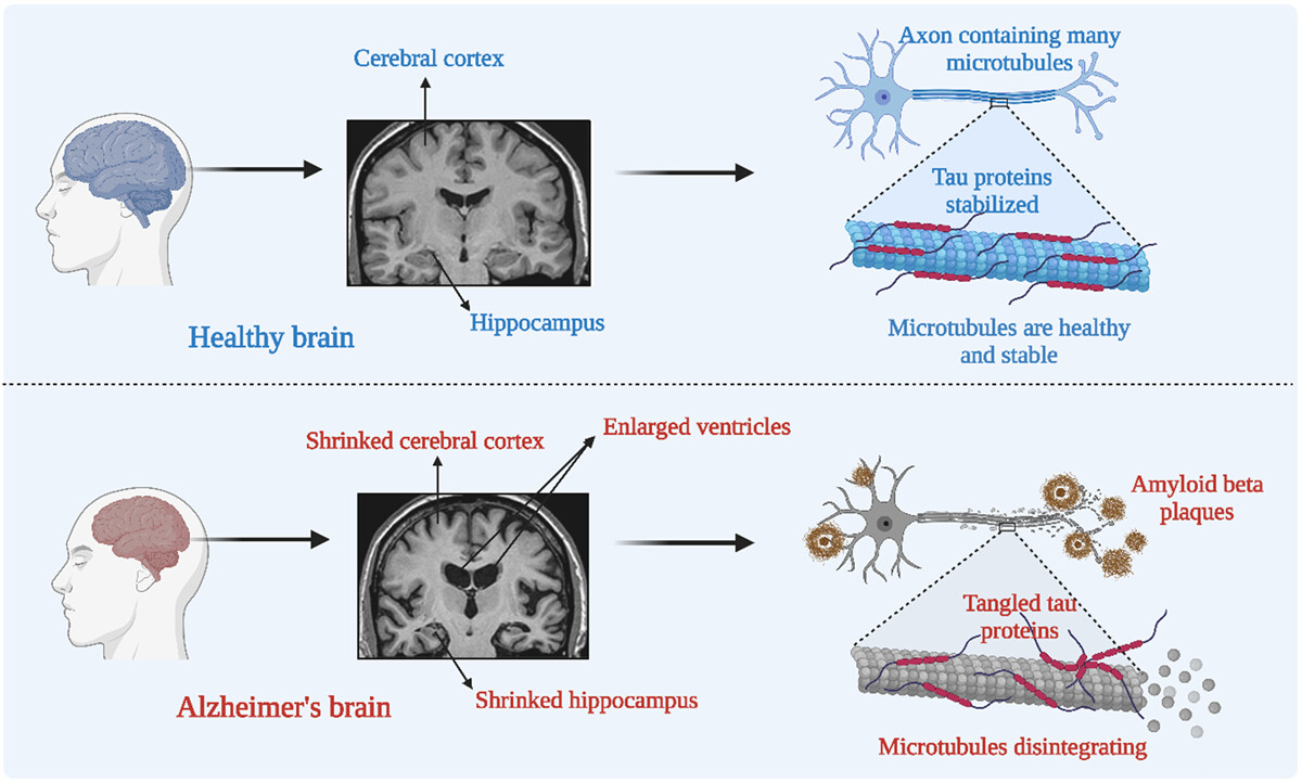 Ethnobotanical significance of medicinal plants: Beta-amyloid and tau aggregation inhibitors against Alzheimer's disease